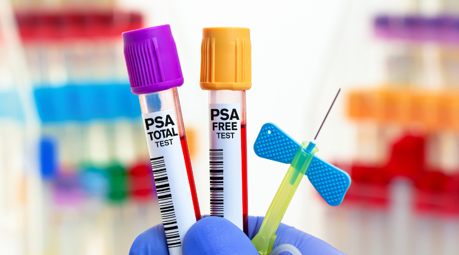 immagine di due provette per l'esame del Psa e di un ago a farfalla per il prelievo